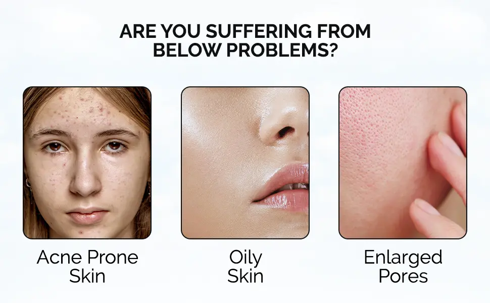 Niacinamide 10% Face Serum