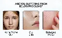 Niacinamide 10% Face Serum